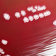 Yersinia pestis being grown in a petri dish.